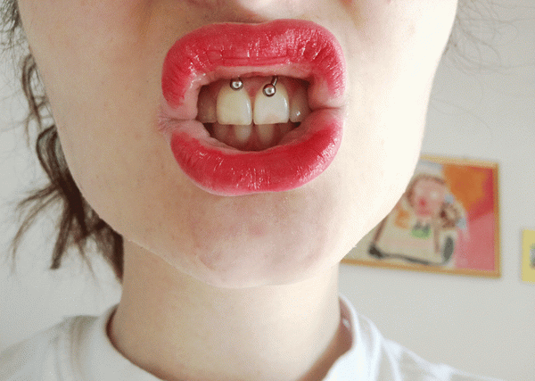 Alt om smiley frenulum piercing