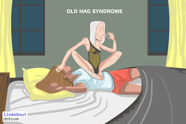 Découvrez le syndrome de Old Hag