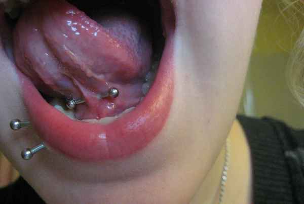 ¿Qué es la piercing oral de la lengua frenulum??