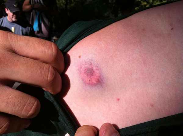 ¿Le duele ser golpeado por un paintball??